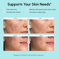 thumbnail image 3 of Crema Facial MAREE Ácido Azelaico 15% 30ml, 3 of 8