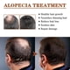thumbnail image 3 of Aceite de ricino y romero YONGSHENG crecimiento cabello femenino seco dañado 50 ml, 3 of 5