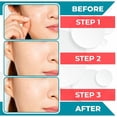 thumbnail image 4 of Hitworker 18pcs Hydrocolloid Pimple Patches - Salicylic Acid Acne Patches for Sensitive Skin, 4 of 5