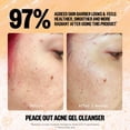 thumbnail image 4 of Gel limpiador para el acné PEACE OUT Skincare 120 ml con ácido salicílico, 4 of 6
