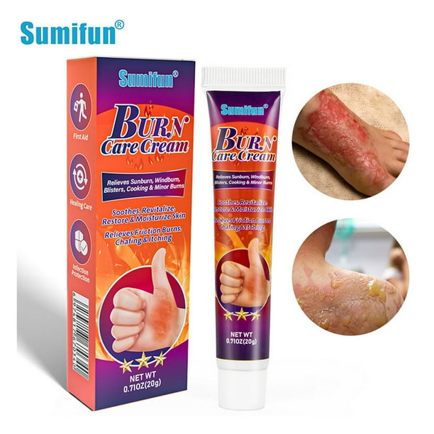 Sumifun 20g Skin Burn Care Relieve Sunburn Windburn Blisters Cooking Burns Healing Care