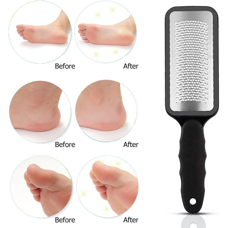 Foot Rasp Hard Skin Remover, Dead Skin Remover for Feet, Pedicure