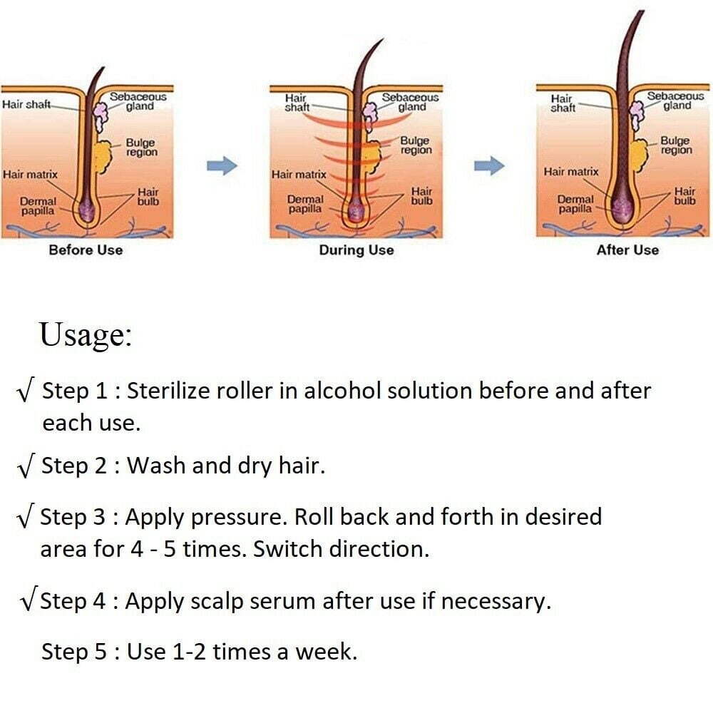 Cosprof 540 Micro-needling Derma Roller Hair Beard Regrowth Anti Hair Loss  Treatment