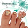 thumbnail image 3 of 3pcs Kerassentials For Toenail Fungus, Kerassentials Toenail Fungus Treatment Oil, 3 of 5