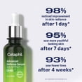 thumbnail image 2 of Serum Cetaphil Advanced Defence para piel estresada 30 mL, 2 of 9