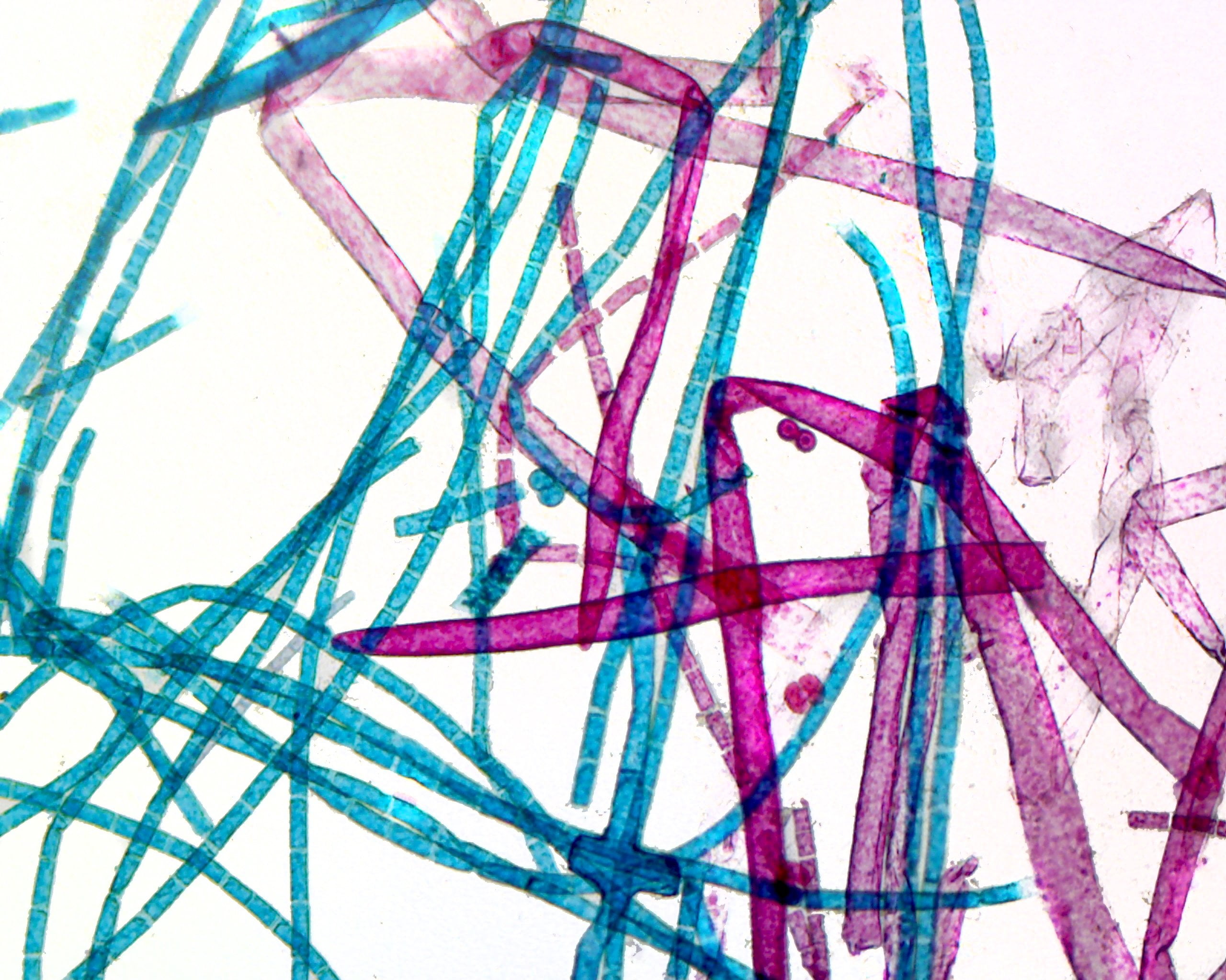 GSC International PS0327 Branching Filamentous Cladophora Whole Mount