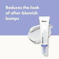 thumbnail image 3 of Hero Cosmetics Rescue Balm Post-Blemish Recovery Cream for Dry Red-Looking Skin, 15 ml, 3 of 8