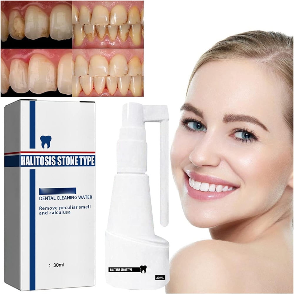Dissolving Dental Spray, Dental Calculus Remover Cleaner, Mouth Refreshing Spray,Intensive Stain