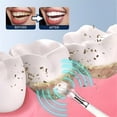 thumbnail image 4 of FACEGA Teeth Hygienicer,Portable Toothbrush,Tartar Remover for Hygienicing Teeth (Black-A), 4 of 4