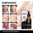 thumbnail image 4 of Alvantor Nail Fungus Treatment, Nail Repair Oil Moisturizing and Daily Care, 1fl.oz, 4 of 7