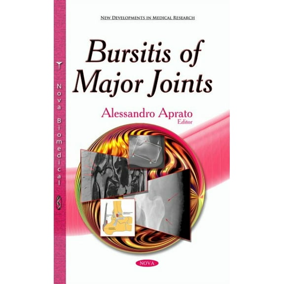 Bursitis of Major Joints