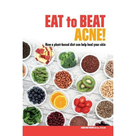 Eat to Beat Acne! : How a Plant-Based Diet Can Help Heal Your