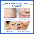 thumbnail image 4 of Teissuly 30ml Facial Serum, Anti Aging Serum, Dark Spot Corrector & Fade Fine Lines Essence (5Pcs) Teissuly WER202401273981, 4 of 9