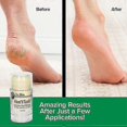 thumbnail image 2 of 2/3pcs Heeltastic Therapy Balm, Foot Massage Cream Intensive Heel Therapy, Foot Care, 2 of 4