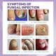 thumbnail image 2 of 2pcs Medinail Nail Fungus Spray Toenail Fungus Treatment, Nail Fungus Treatment For Toenail Gray Nail Repair Spray, 2 of 5