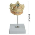 thumbnail image 4 of Dental Anatomy Model for Medical Science Dentist Dentistry, 4 of 14