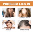 thumbnail image 3 of Hair Treatment Oil, 14PCS Non Irritating Hair Serum  for Home, 3 of 8