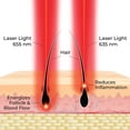 thumbnail image 6 of Actonis 18 Laser Comb FDA Cleared Hair Growth & Regrowth Device (Dark Silver), 6 of 9