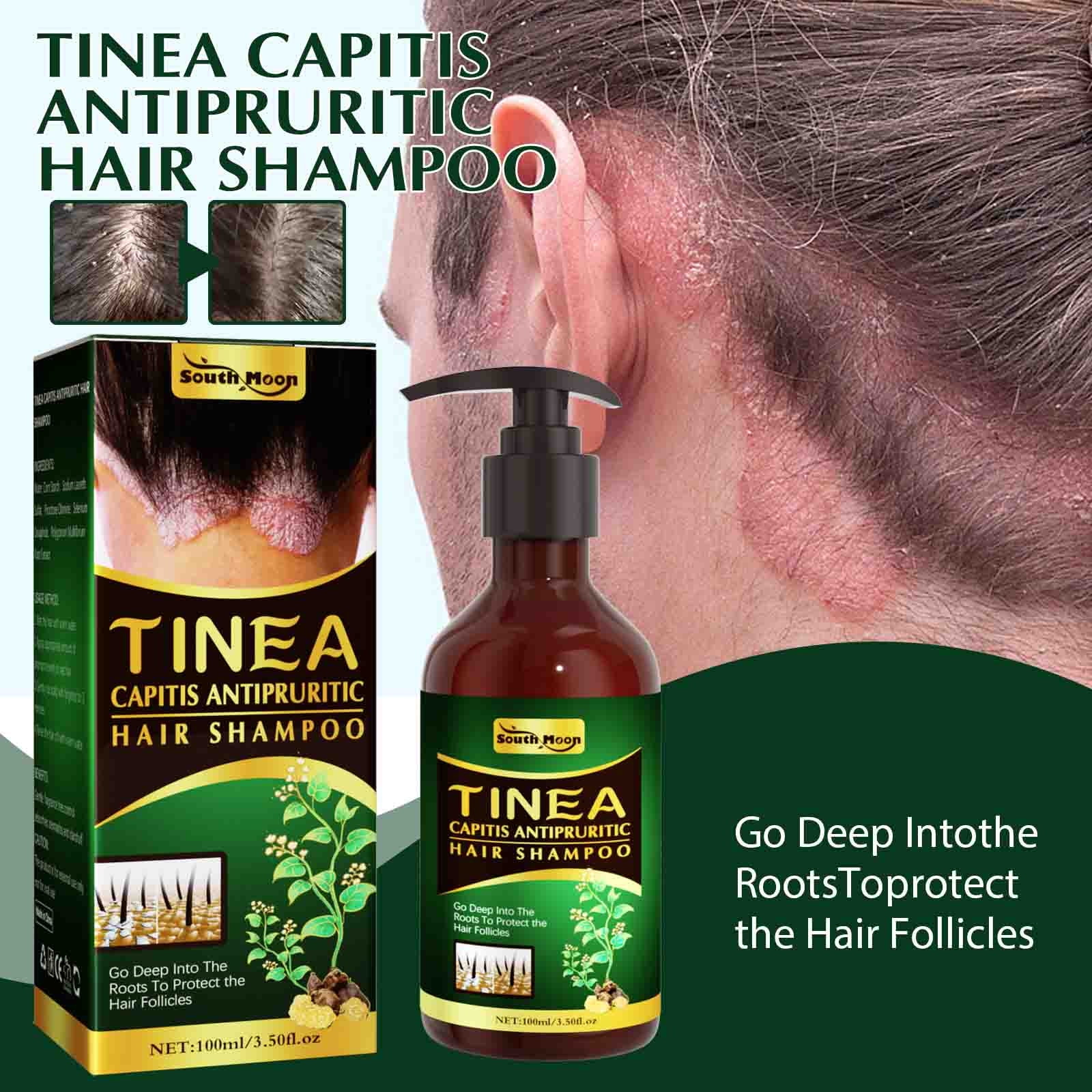 Hair Moss Anti-itching Shampoo Scalp Cleansing Anti-dandruff Hair Oil  Control Anti-itching Refreshing Repair 100ml 