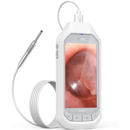 Depstech Digital Ear Wax Remover Otoscope with LED Lights, (FHD Ear Checker and Cleaning Camera with Battery)