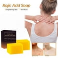 thumbnail image 2 of Jabón de cúrcuma con ácido kójico: limpiador, antiacné, calmante y espumoso. Cuidado natural de la piel. Paquete de regalo de 4 unidades., 2 of 4