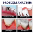 thumbnail image 5 of Toothache Spray Gum Swelling Toothache Toothache Water Licorice Tooth Decay Worm Tooth Fire Caries, 5 of 5