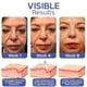 thumbnail image 5 of Lifting Eyelid Defining Cream, Double Eyelid Shaping Cream, Eyelid Lift Cream, Long-acting Invisible Double Eyelid Shaping Cream 5ml, 5 of 5