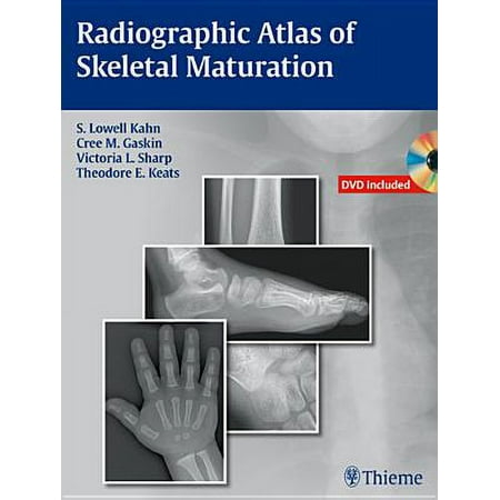 UPC: 9781604065718 | Radiographic Atlas of Skeletal Maturation