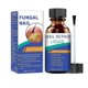 thumbnail image 1 of Nail Repairing Liquid, Speedy and Effective Approach to Toenail Issues - Combating Thick, Discolored Nails - Powerful Solution for Addressing Yellow a, 1 of 4