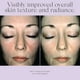 thumbnail image 5 of Crema de noche EXUVIANCE Overnight Transformation 50 ml con ácido hialurónico, 5 of 7