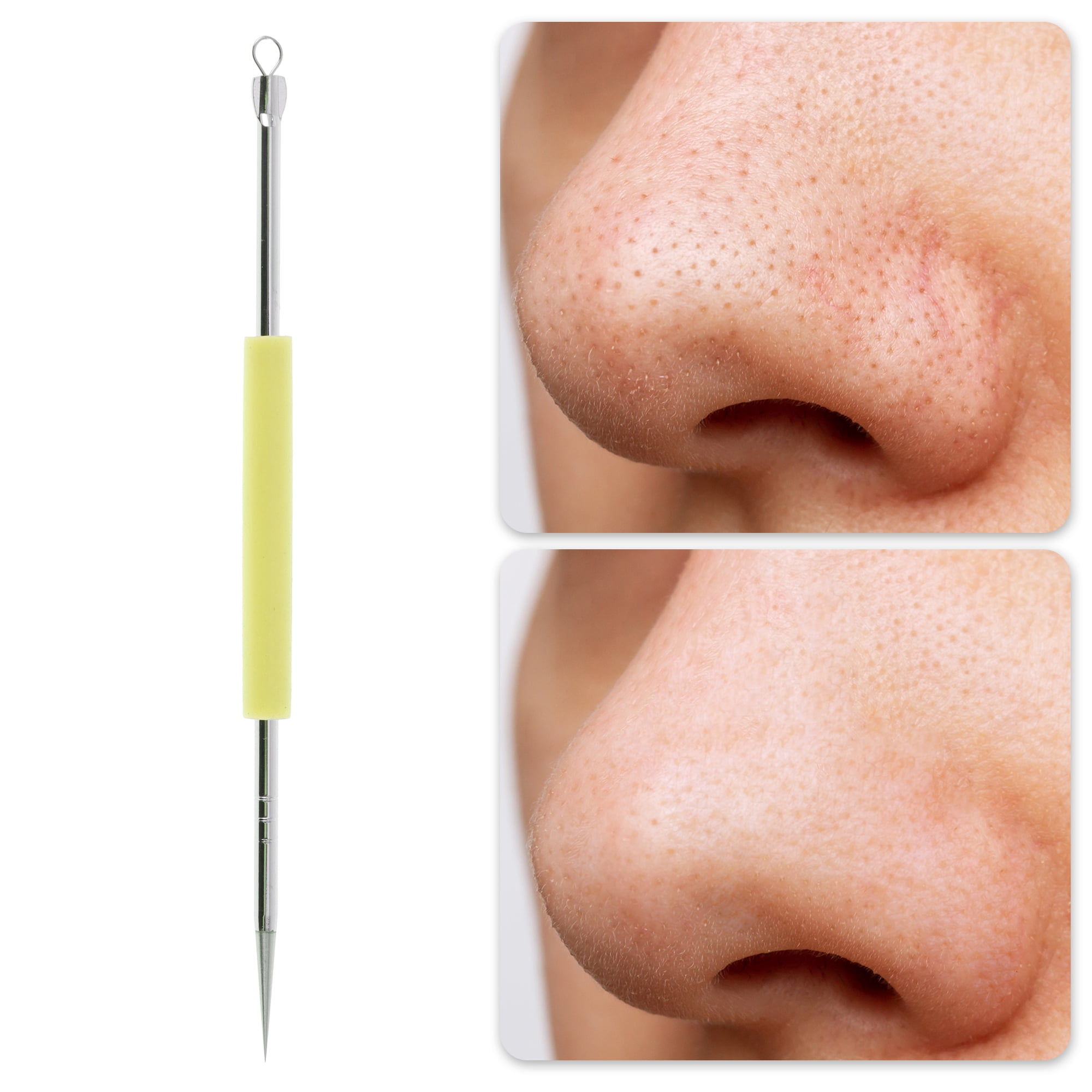 Unique Bargains Professional Durable Pimple Extractor Tool 4.92 Length 1 Pcs Yellow