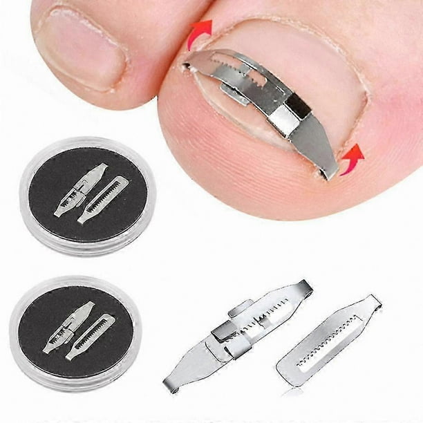 Ingrown Toenail Correction Tool Stainless Steel Curved Brace for Pedicure Straightening and Nail Care