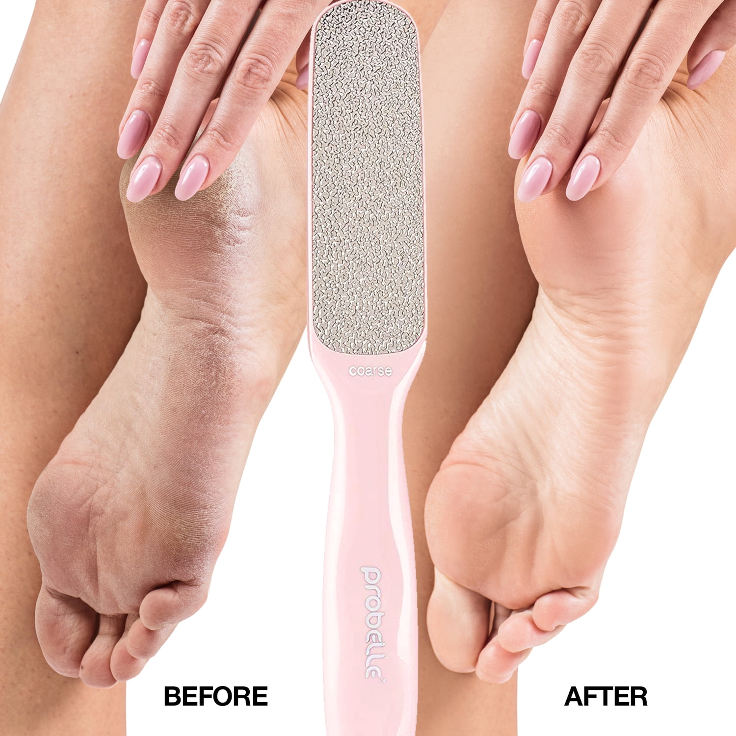 Buy Mepoint Double Sided Foot Scrubber for Dead Skin,Pedicure