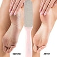 thumbnail image 2 of "Probelle Double Sided Multidirectional Nickel Foot File Callus Remover - Immediately reduces calluses and corns to powder for instant results, safe tool (Pink)", 2 of 5