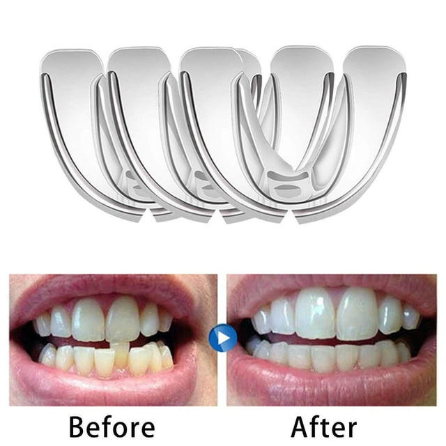 3-en-1 Rétenteur de Dents, Plateaux d'Alignement de Dents, Protecteurs Orthodontiques