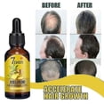 thumbnail image 4 of Hair Growth Essence Hair Loss Scalp Treatments Ginger Ginseng Raise Dense Hai, 4 of 4