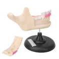 thumbnail image 4 of Raíz Caries Dientes Dientes Enfermedad Dental Anatómico Biológico Dentista Modelo de Enseñanza, 4 of 8