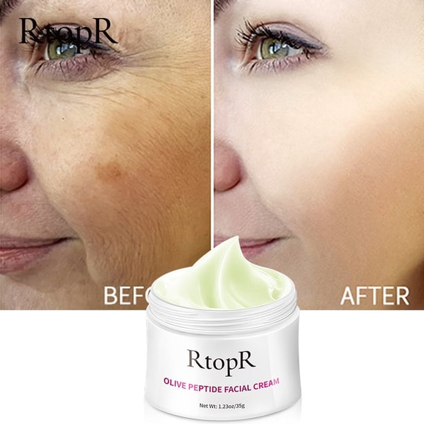 Corrector de insectos blanqueador de la piel, crema facial para eliminar imperfecciones, reduce las manchas de las pecas, 20g"one" Fivean LED