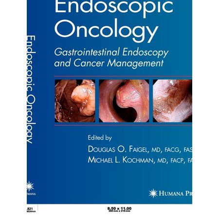 UPC: 9781588295323 | Endoscopic Oncology (Hardcover)