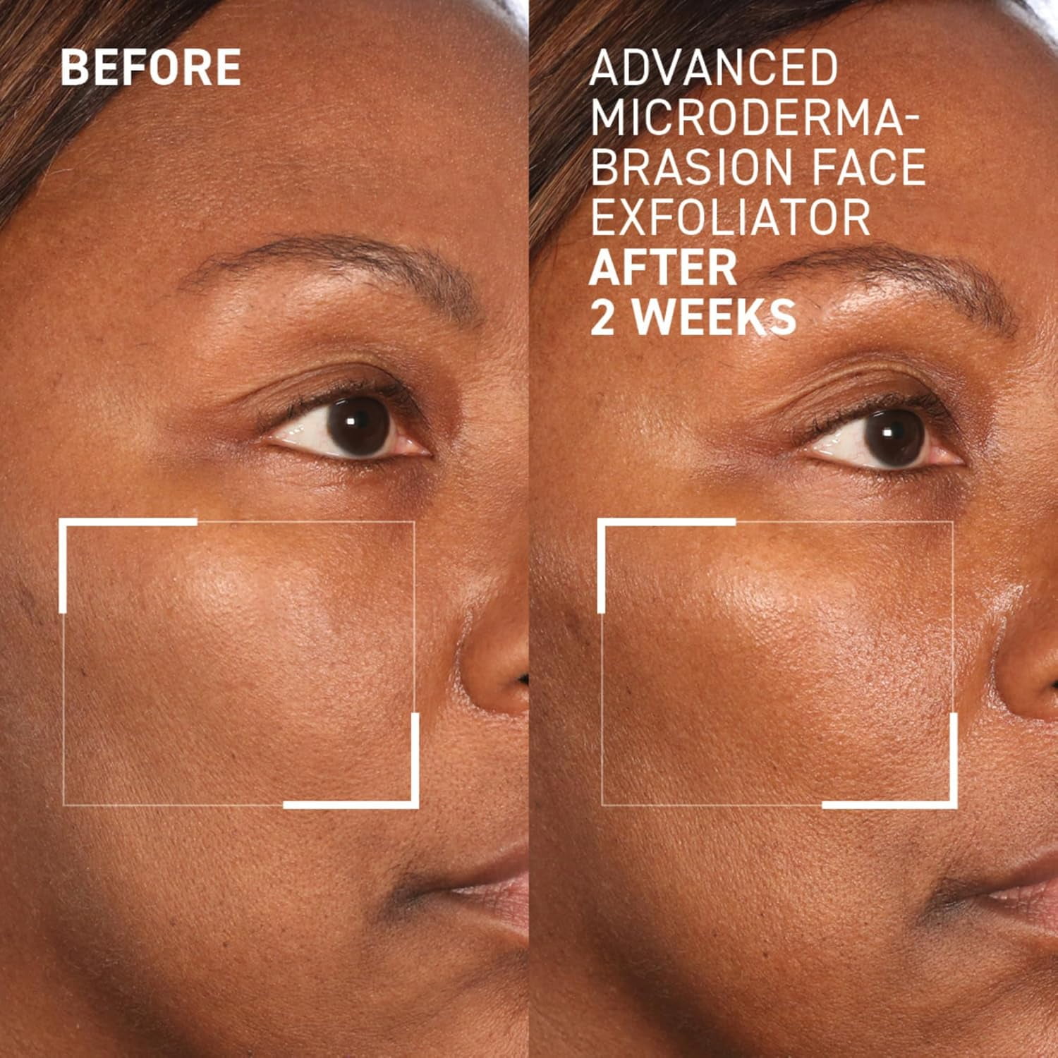 Dr. Brandt Advanced Microdermabrasion Face Exfoliator