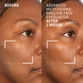 thumbnail image 2 of Dr. Brandt Advanced Microdermabrasion Face Exfoliator, 2 of 11