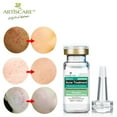 thumbnail image 1 of Esencia Surem Oil Extracto antiarrugas Eliminación de marcas de tratamiento, 10 ml de esencia, 1 of 9