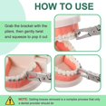 thumbnail image 3 of Alicates para quitar el soporte anterior, kit de herramientas para quitar los soportes, removedor de soportes para quitar los soportes de acero inoxidable, pinza para el soporte de los dient, 3 of 5