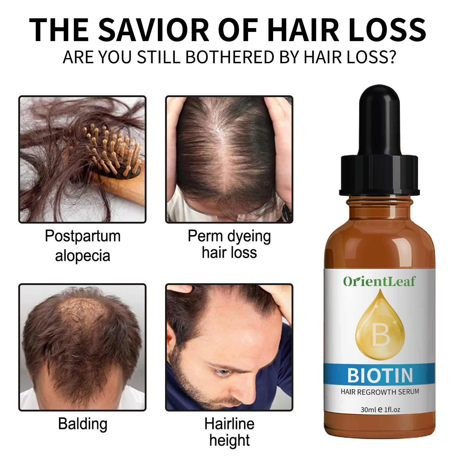 OrientLeaf Biotin Hair Growth Serum Advanced Topical Formula to Help Grow  Healthy, Strong Hair Suitable for Men and Women of All Hair Types Hair Loss  Support, Christmas Gift Set 