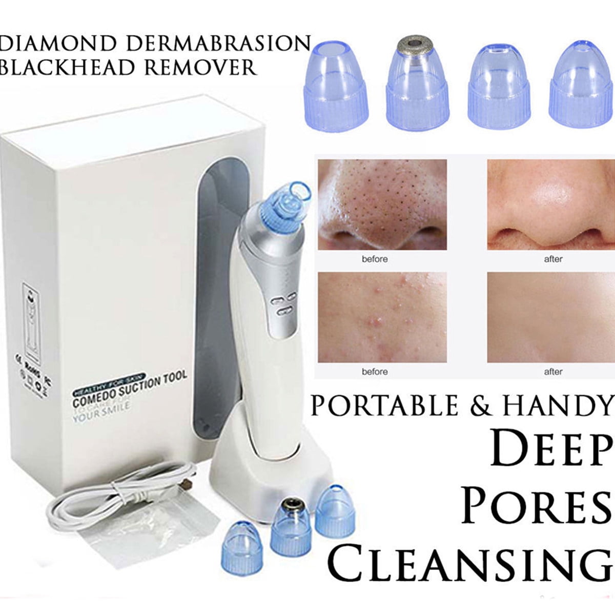 Comedo Microdermabrasion Vacuum Suction Pore Blackhead Remover Cleaner