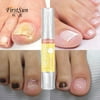 Nail Treatment Essence Nail Treatment Essence Nail and Foot Whitening Toe Nail Fungus Removal