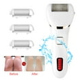 thumbnail image 1 of Electric Callus Remover Professional Rechargeable Dead Hard Skin Remover Foot Pedicure Tools, 1 of 8