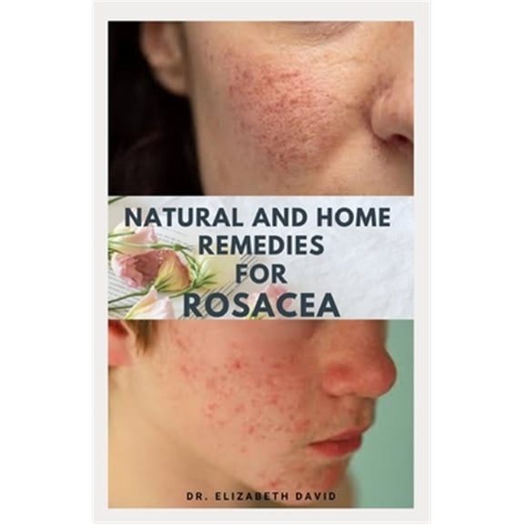Pre-Owned Natural and Home Remedies for Rosacea, (Paperback)