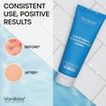 thumbnail image 4 of Vanibiss Butt and Thighs Acne Treatment Cream with 2% Salicylic Acid, Exfoliates & Repairs Acne-Prone Skin, 4oz, 4 of 8