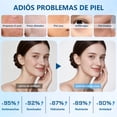 thumbnail image 2 of WEUD Skin Care Coreano 4 En 1 Kit, con 1 Crema Hidratante Niacinamida + 1 Contorno de Ojos con Retinal + 1 Serum Centella &Aacute;cido Hialur&oacute;nico + 1 Serum P&eacute;ptidos Prop&amp, 2 of 6